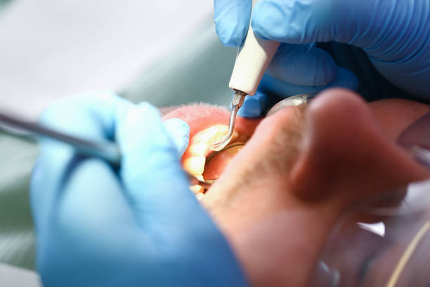 Best Urgent Dental Care in Breckenridge, MI